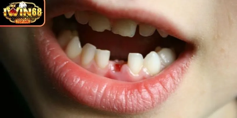 Lý giải cặn kẽ và chi tiết một số giấc chiêm bao